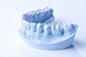 cava_de_tirreni_sito_dentista-studio-dentistico-gigantino- conservativa