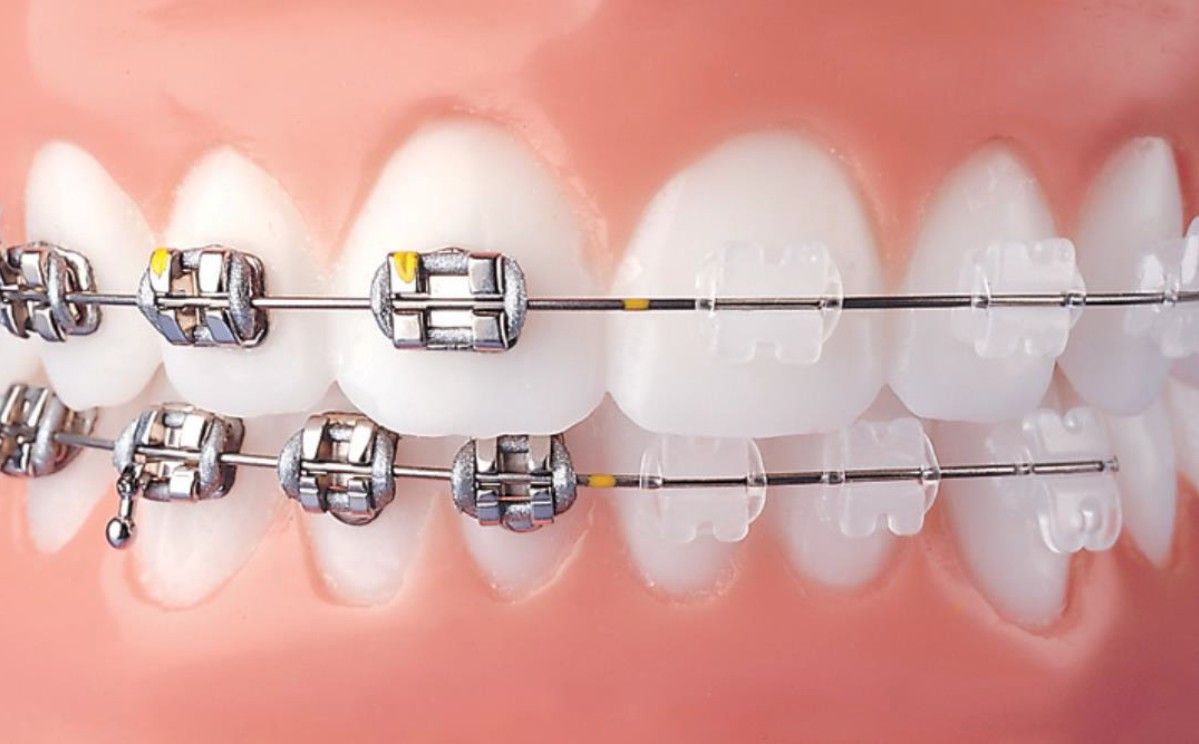 cava_de_tirreni_dentista-studio-dentistico-gigantino-ortodonzia